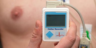 24 hr Holter monitoring