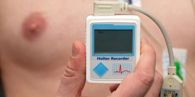 24 hr Holter monitoring for arrhythmia detection for palpitations and lightheadedness