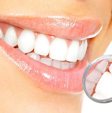 smile, dentistry, dentist near me, best dentist, gentle dental, teeth whitening, veneers