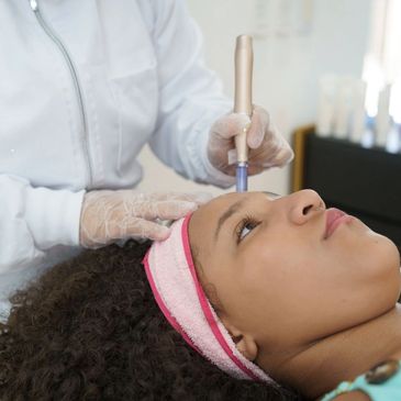 SkinPen Microneedling