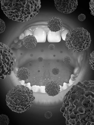 oral pathology oral cancer oral screening best doctors biopsy best oral surgery nwi 