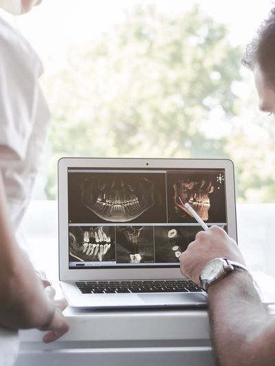 multiple implants dental implants tooth extraction best oral surgery practice nwi northwest indiana