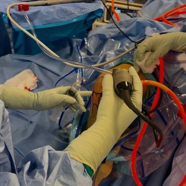 Manos con guantes realizando una cirugía ortopédica en una rodilla.