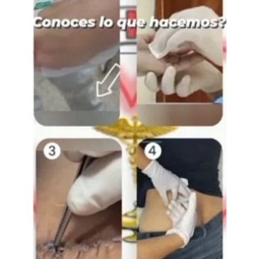 PROCEDIMIENTOS DE ENFERMERIA