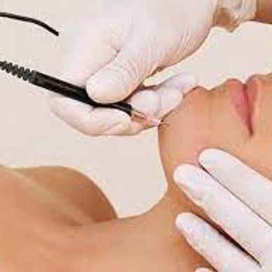 Accredited blemishes removal training