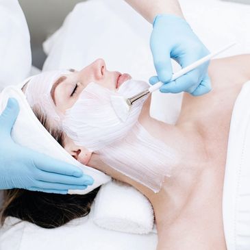 Chemical Peel