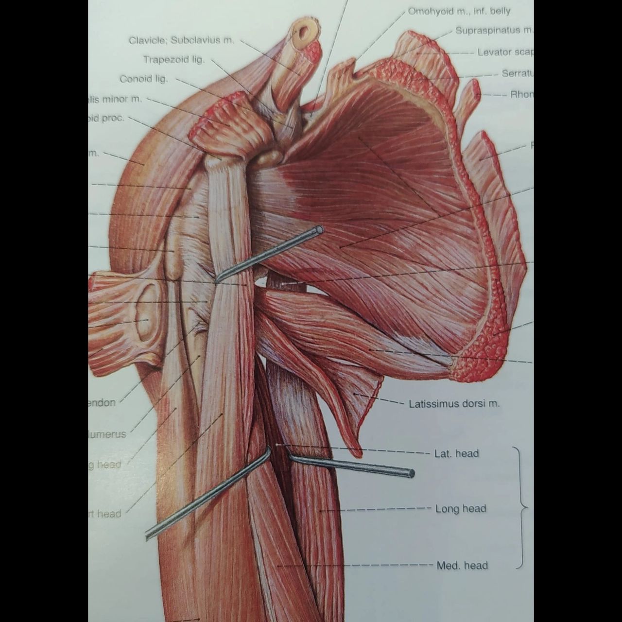Subscapularis - Sobotta Atlas of Human Anatomy