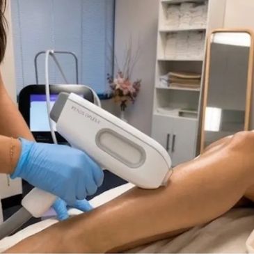 Laser Hair Removal Offer — Full Legs, Brazilian & Underarms at Solo Esthetics And Skin Spa in Sterli
