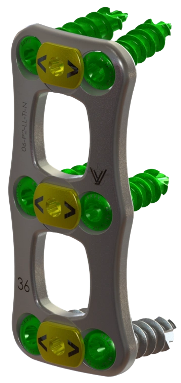 VyPlate™ Cervical Plate