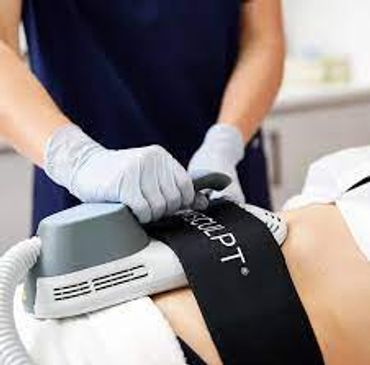A single Emsculpt session results in 20,000 crunches that tone, sculpt, and define your ab muscles