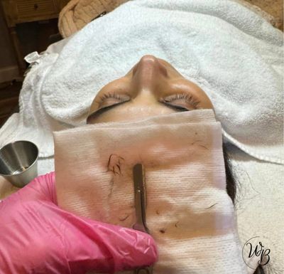 Professional dermaplaning facial treatment performed at Tru U Esthetix in Franklin, TN removing dead