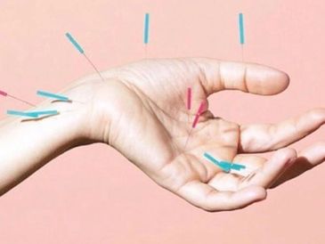 Hand acupuncture