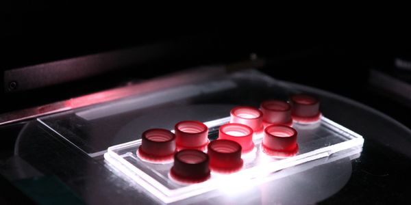 Picture of a microfluidic chip