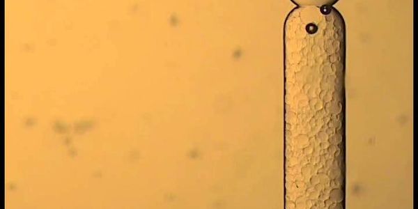 Picture of a microfluidic channel filled with beads.