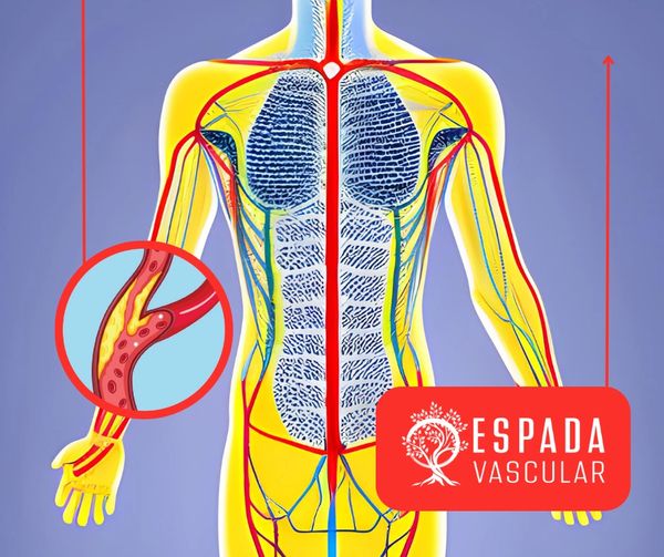 A diagram of the human body and the vascular system.