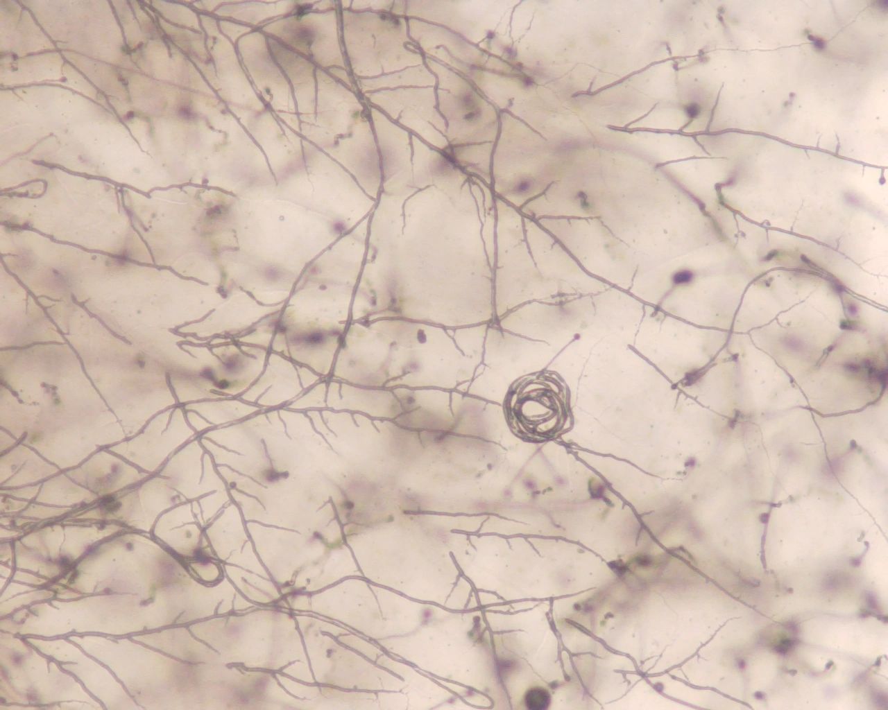 Soo Chan Lee TTUHSC | Leading Medical Mycology Research