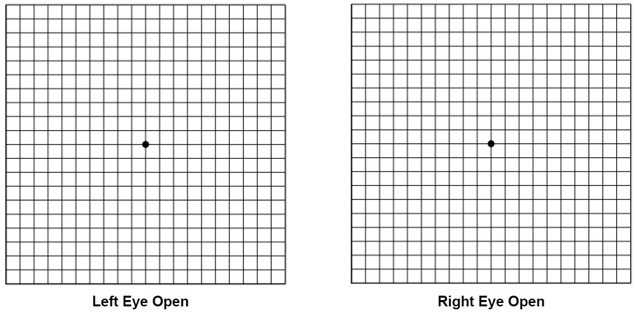 Amsler Grid  Vitreo-Retinal Consultants, Inc.