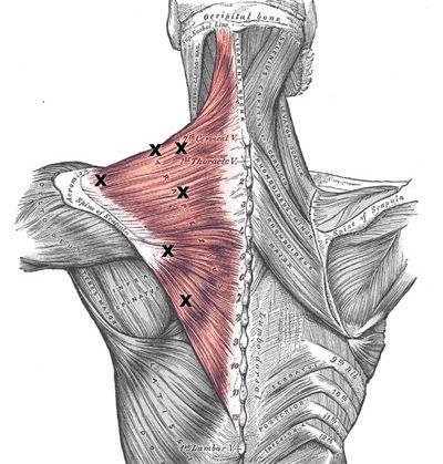 What is a Muscular Trigger Point?