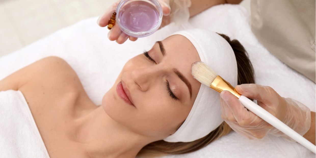 Chemical Peels