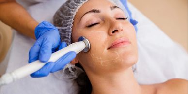 Radiofrequency treatment