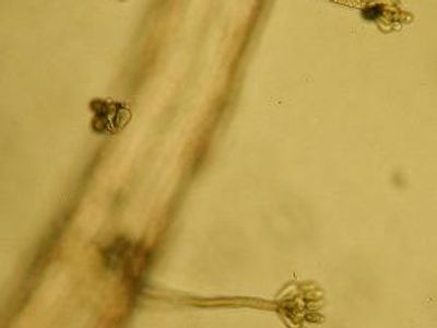 Stachybotrys chartarum (also referred to a black mold) is a greenish-black mold. 