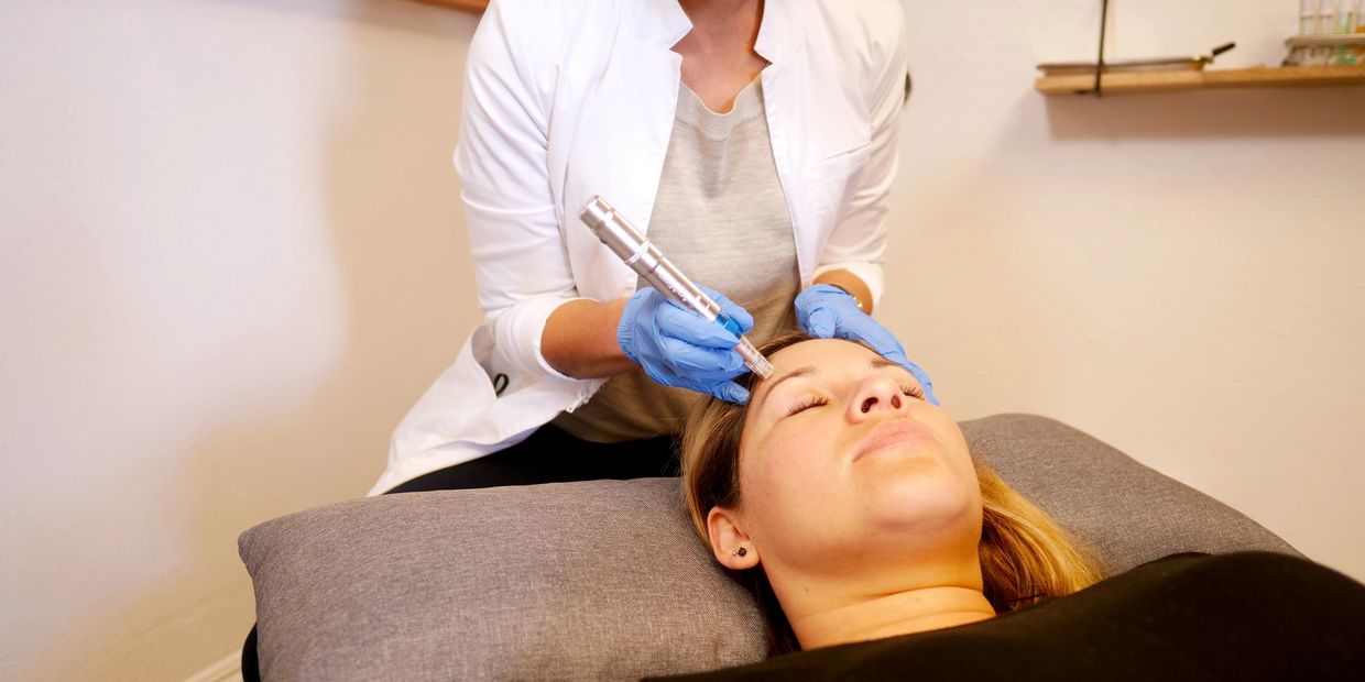 Patient receiving Microneedling facial in Safety Harbor, Florida for anti-aging
