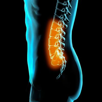 Image representation of spinal pain
