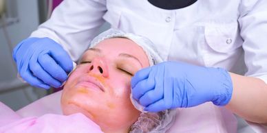 chemical peels, peeling, face peeling