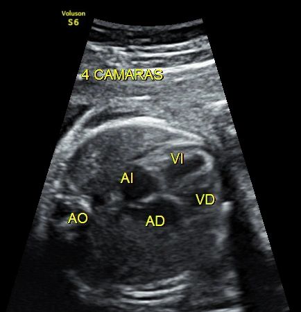 ULTRASONIDO ESTRUCTURAL