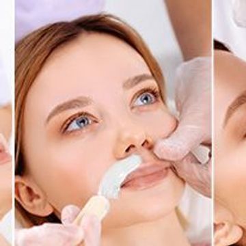 ingrown hair 