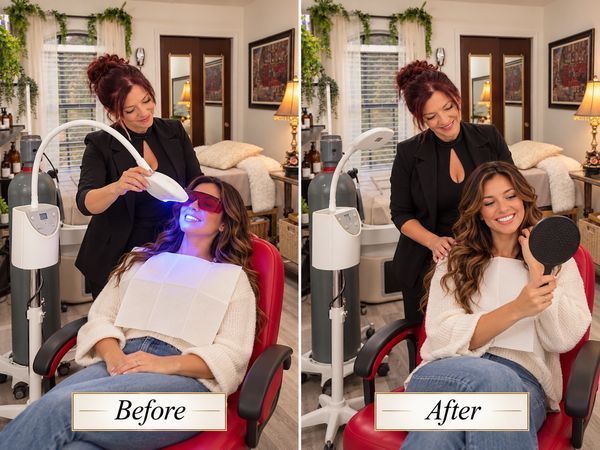 Teeth Whitening at Michelle's Luxury Hair and Wellness Lewisville Tx