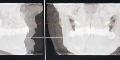 Cone Beam Computed Tomography Systems (CBCT)