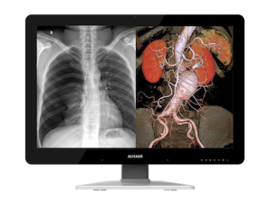 The JUSHA 6MP diagnostic monitor combines exceptional image clarity with a sleek edge-to-edge glass design and versatile split-screen capability. Built for radiologists and healthcare professionals, it delivers precise grayscale performance, accurate diagnostic imaging, and efficient PACS workflows for hospitals, imaging centers, and teleradiology environments.