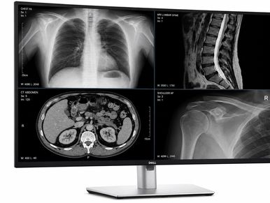 Budget-friendly high-resolution clinical monitor with excellent contrast, deep blacks, and sharp image quality for medical offices, healthcare workstations, PACS review, and clinical imaging applications.
