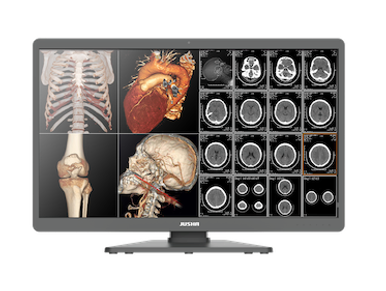 The JUSHA 8MP diagnostic monitor delivers exceptional image clarity with an advanced split-screen display, allowing radiologists to efficiently review multiple studies simultaneously. Designed for PACS workflows, diagnostic imaging, and enterprise reading rooms, it provides outstanding performance, precision, and reliability.