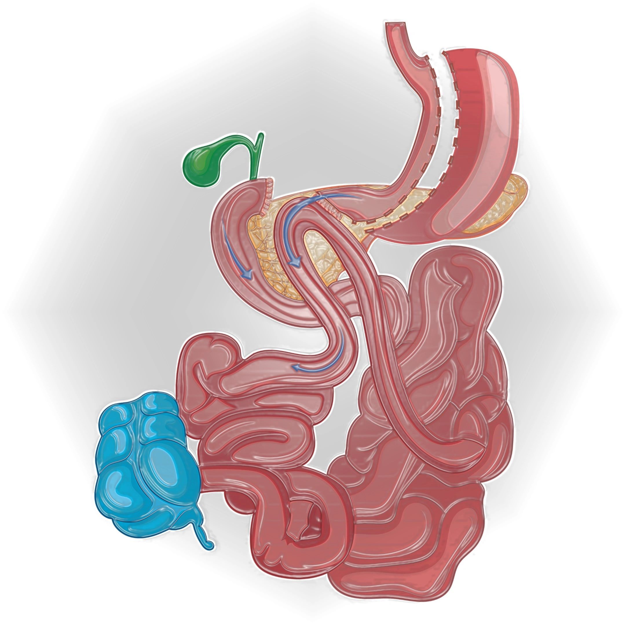 Malabsorptive Procedures SADI S And Updated Surgery Guidelines