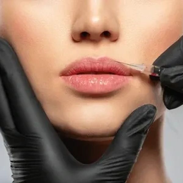 Photo of a Black Gloved provider Injecting lips