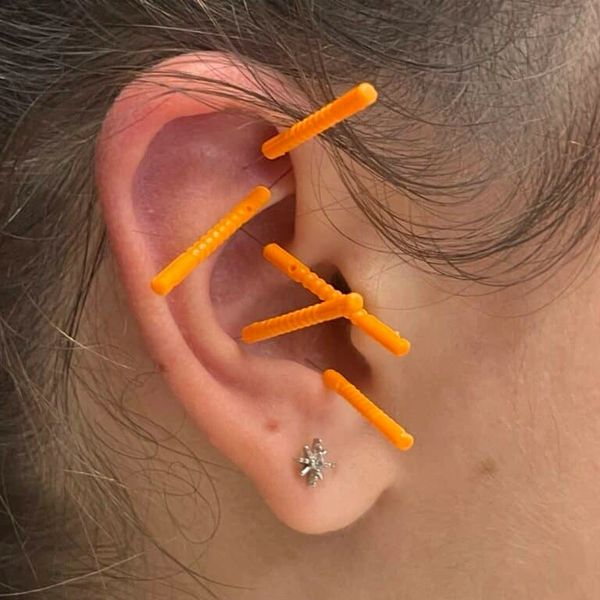 An ear with multiple small orange plastic wall anchors inserted in it.