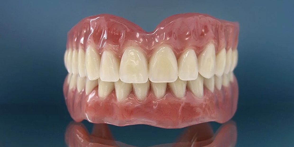 Immediate Dentures: High-Impact Acrylic. Ready to Wear After Extractions!