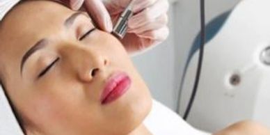 Microdermabrasion, Skincare Treatment, Acne Facial, Best Facial, Facial near me, Five Star Facial