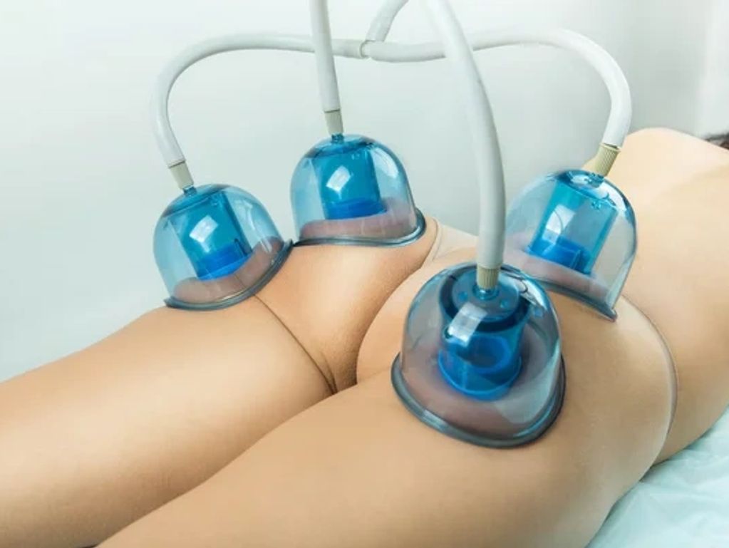 Professional Buttocks Breast Enlargement Cupping Vacuum Breast