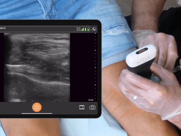 Ultrasound Guided Injection Of The Knee