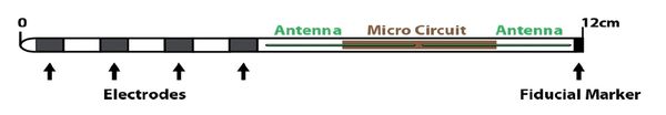 Stimwave, StimQ, PNS, Laura Perryman