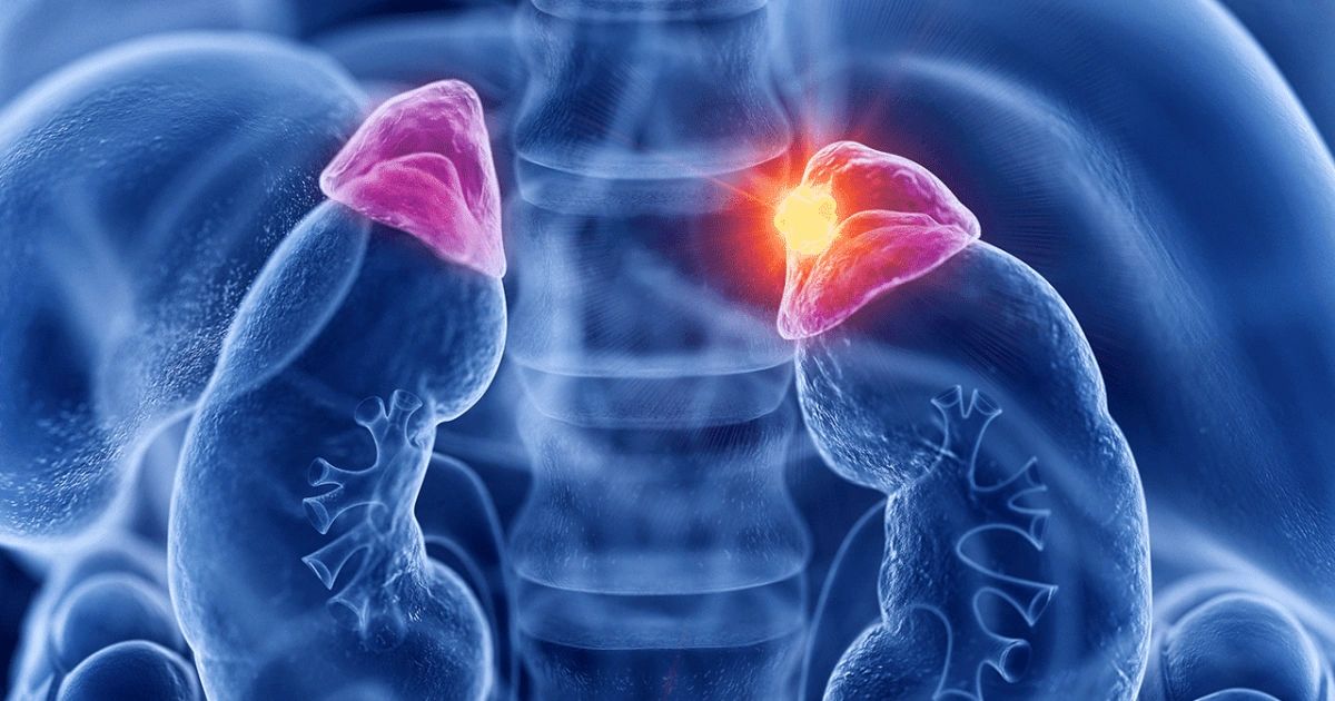 Histologia Da Doenca De Addison