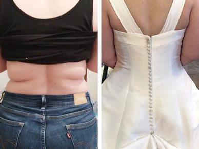Cavi-Lipo ultrasound and laser treatments for safe fat loss