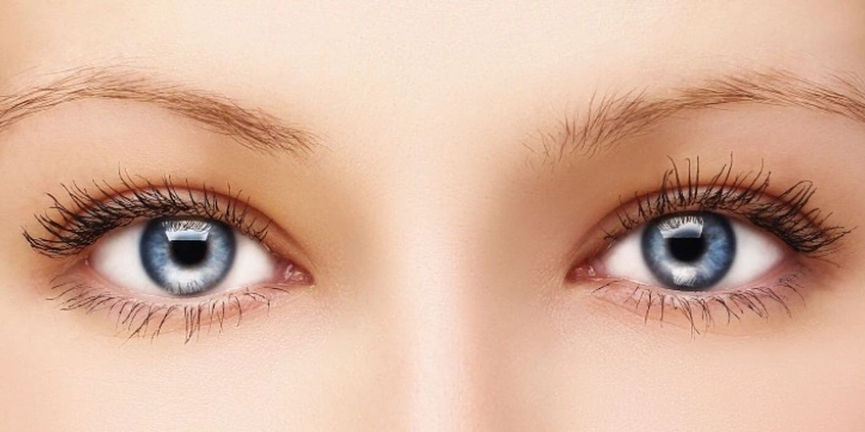 Tear trough fillers in Stockport hazel grove and Cheshire by nurse Debbie