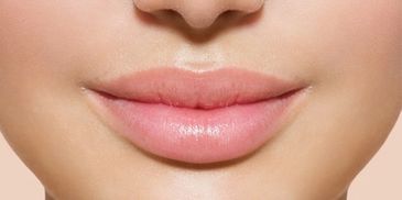 Dermal fillers in Wilmslow  and Hazel Grove stockport