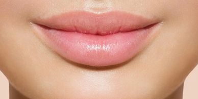 Dermal fillers in Stockport hazel grove and Wilmslow Cheshire 