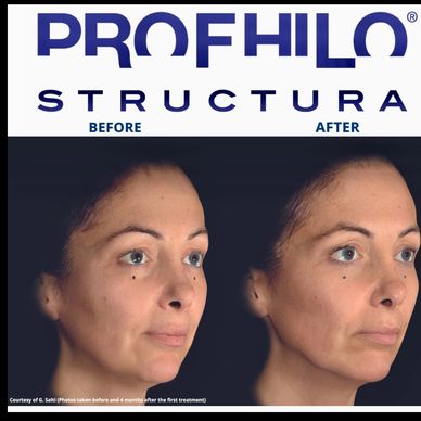 Aesthetics in Hazel Grove Stockport and Wilmslow 