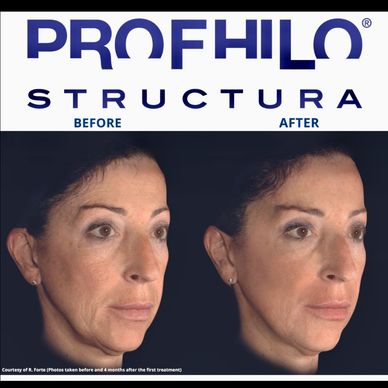 Aesthetics in Wilmslow 